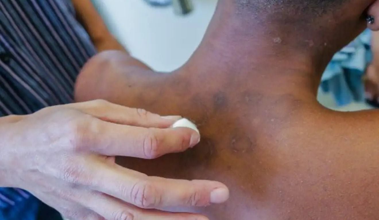 Foto: SMS de Mesquita/RJ/Reprodu&ccedil;&atilde;o