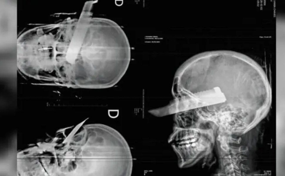 Foto:
                Divulga&ccedil;&atilde;o/Pol&iacute;cia Civil SC
              
            
          
        
  

  

  


			Uma mulher conseguiu fugir ap&oacute;s ser esfaqueada e agredida pelo companheiro na manh&atilde; de