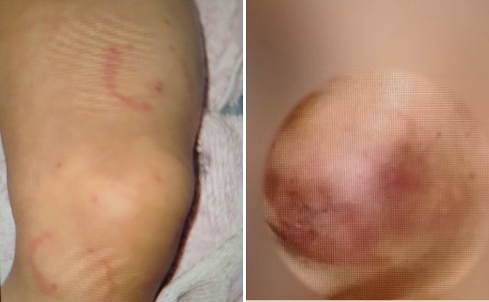 Foto:
                Reprodu&ccedil;&atilde;o/TV Tribuna
              
            
          
        
  

  

  


			A m&atilde;e e o padrasto de uma crian&ccedil;a de sete meses foram presos na tarde ter&ccedil;a-feira (3), suspe