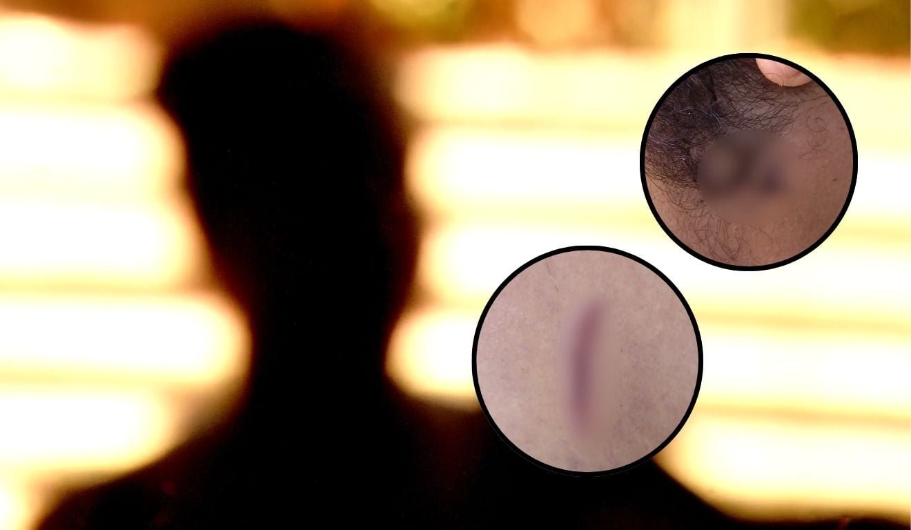 Mulher &eacute; esfaqueada pelo ex-companheiro ap&oacute;s suspeito deixar a pris&atilde;o em Vila Velha