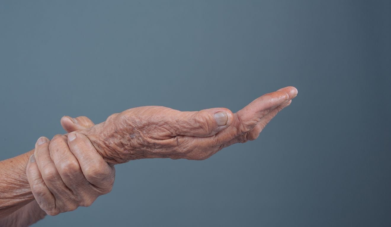 Jap&atilde;o aprova primeiro tratamento de Parkinson com c&eacute;lulas-tronco do mundo