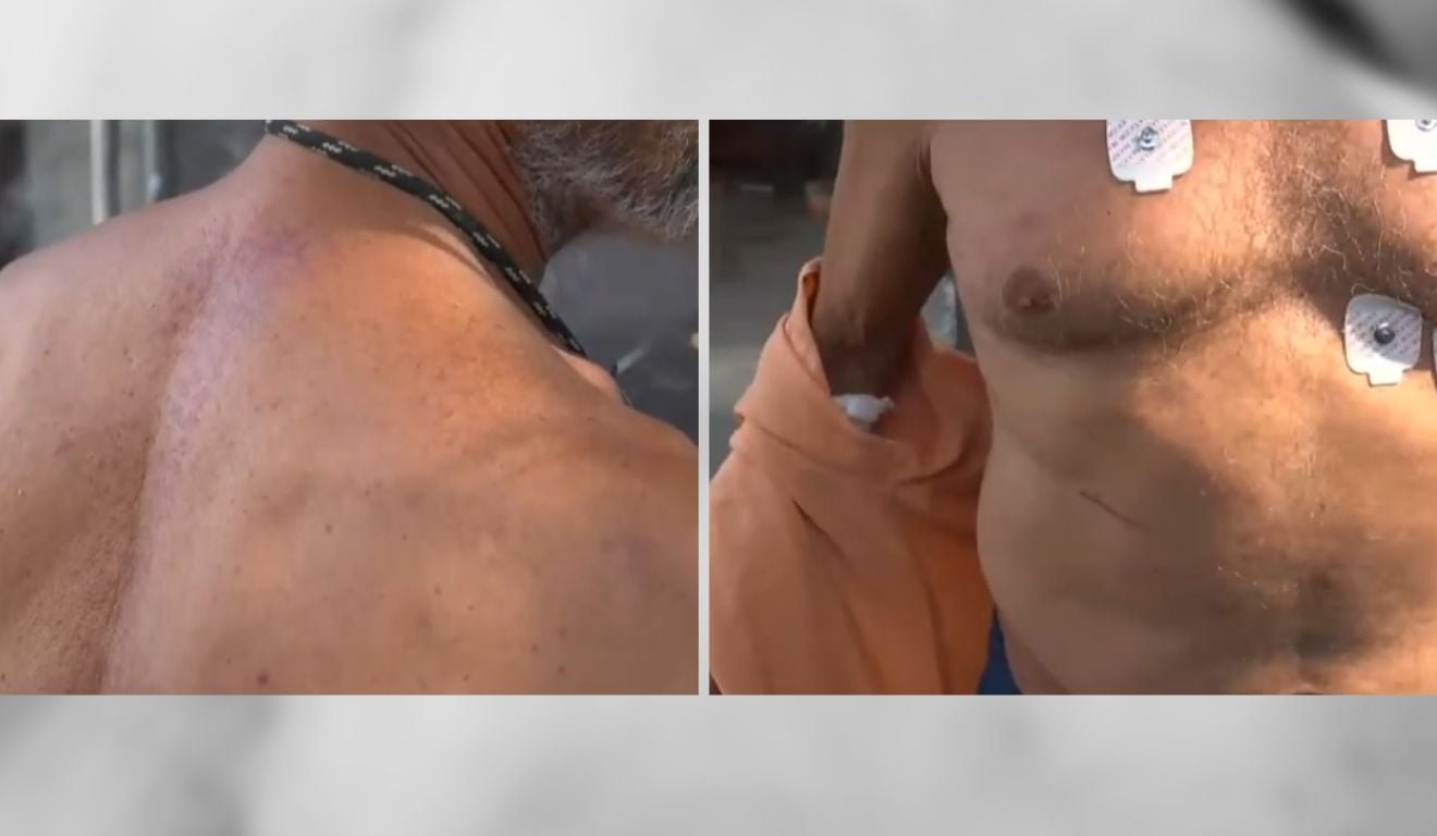 Argentino de 64 anos &eacute; agredido e assaltado ap&oacute;s ter casa invadida na Serra