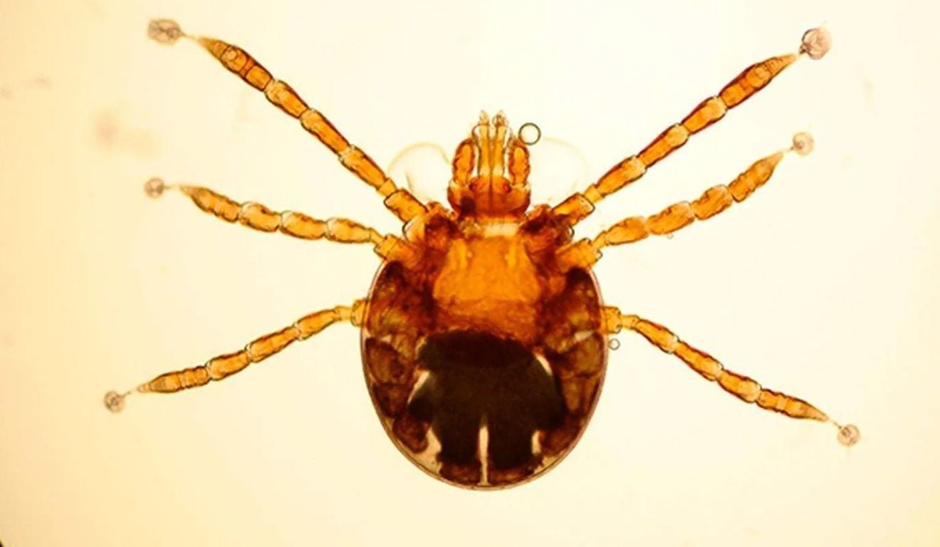 Carrapato-estrela: crian&ccedil;a morre de febre maculosa em cidade do ES