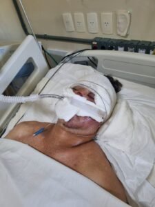 Agricultor espancado ap&oacute;s atropelar cavalo segue internado