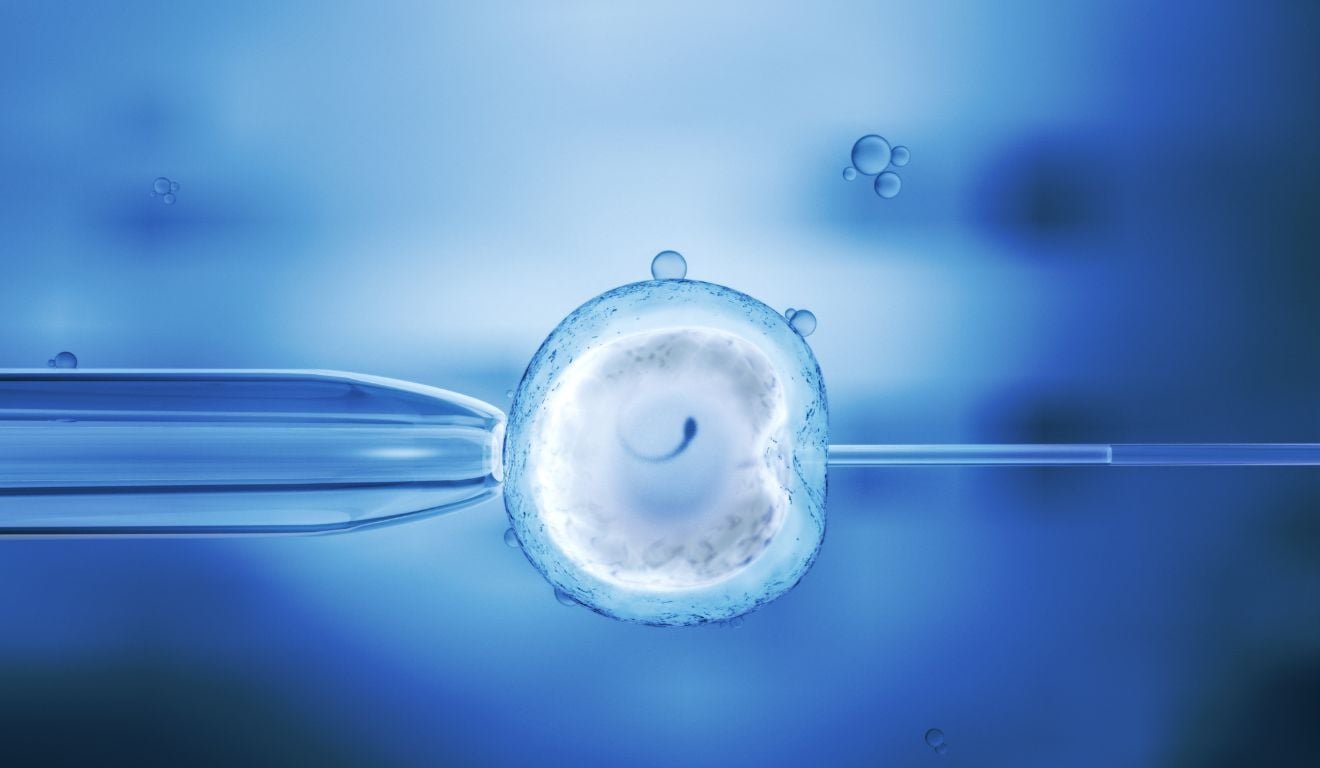 Fertiliza&ccedil;&atilde;o in vitro: o que &eacute;, para quem &eacute; indicada e o que esperar do tratamento