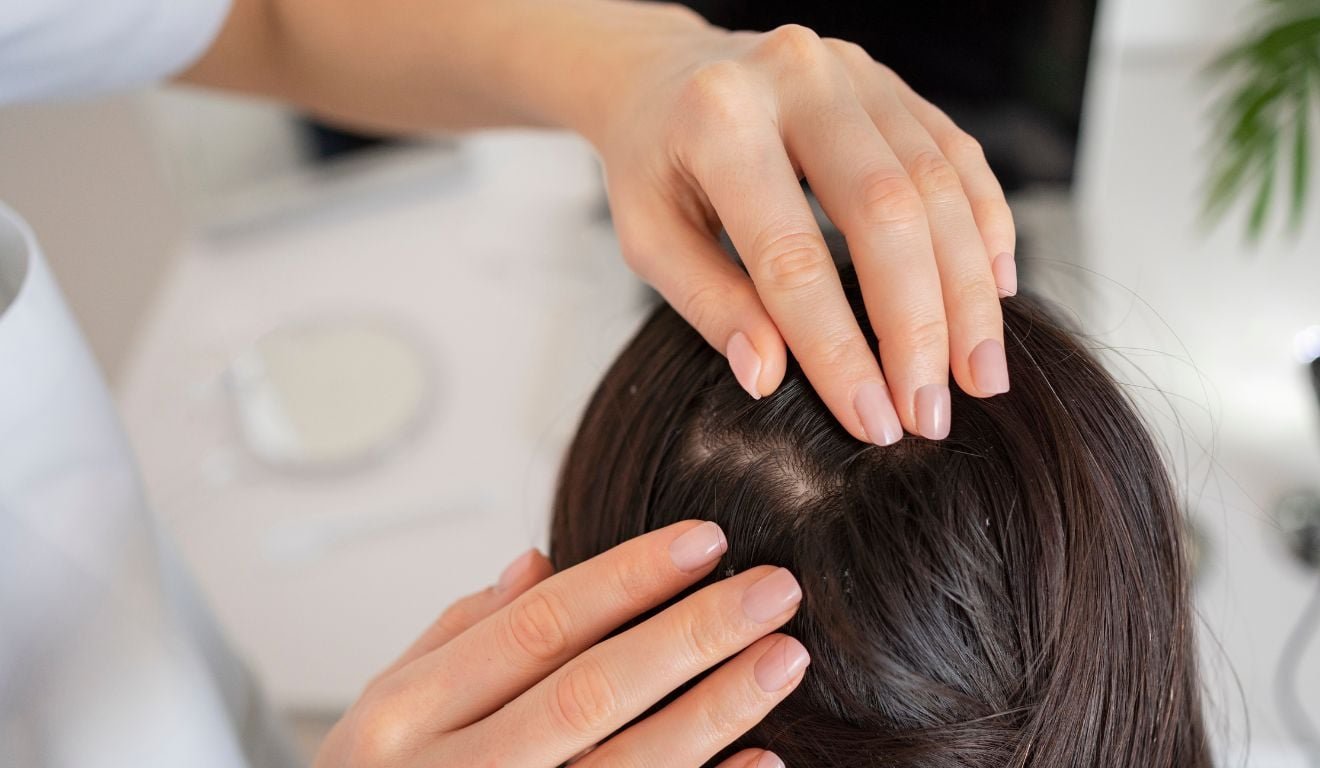 Menopausa e andropausa podem causar queda de cabelo e calv&iacute;cie; entenda