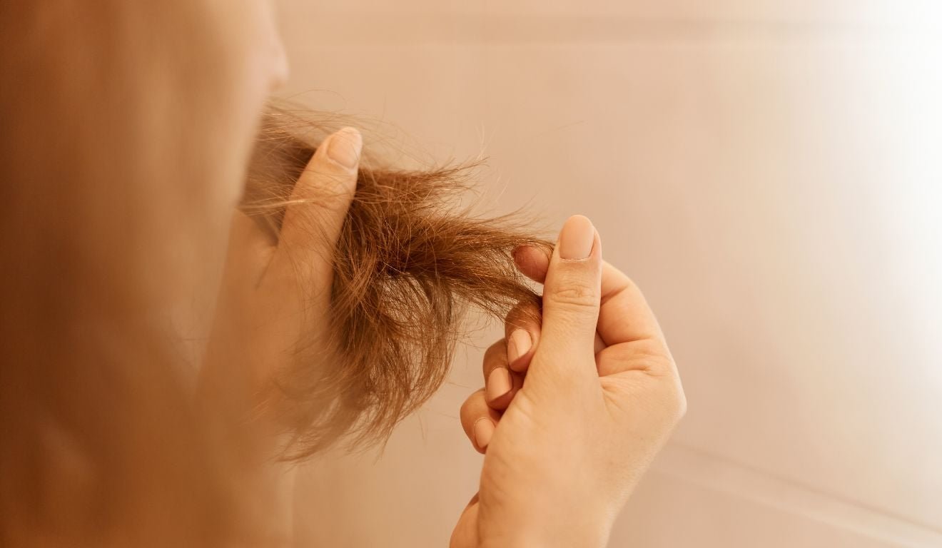 Queda de cabelo tem cura? Conhe&ccedil;a os tipos de alopecia e quando procurar ajuda
