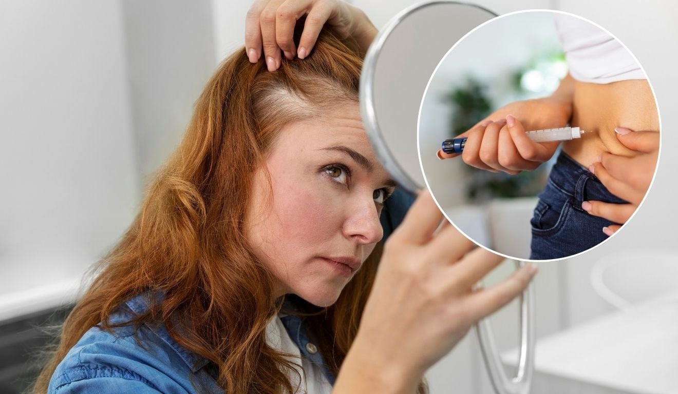 Queda de cabelo ap&oacute;s caneta emagrecedora? Estudo aponta risco relativo at&eacute; 68% maior