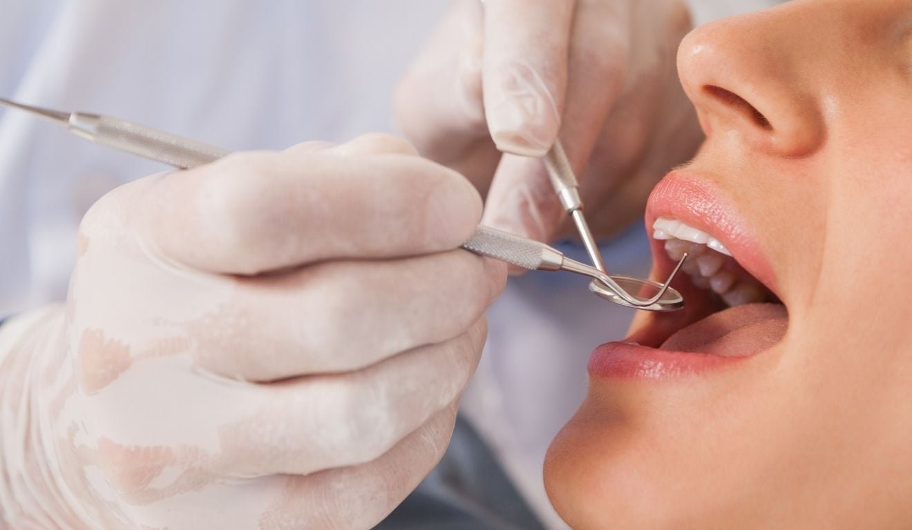 Vale a pena trocar restaura&ccedil;&otilde;es dent&aacute;rias antigas apenas por est&eacute;tica?