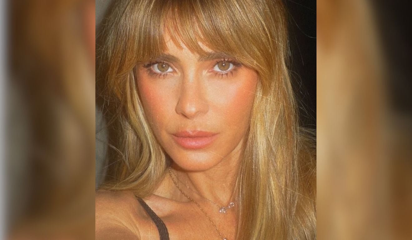 O tratamento que Carolina Dieckmann escolheu para a pele e que ganha cada vez mais adeptos