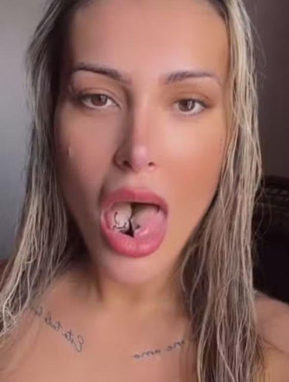 Andressa Urach quer reverter l&iacute;ngua bifurcada ap&oacute;s acidente &iacute;ntimo