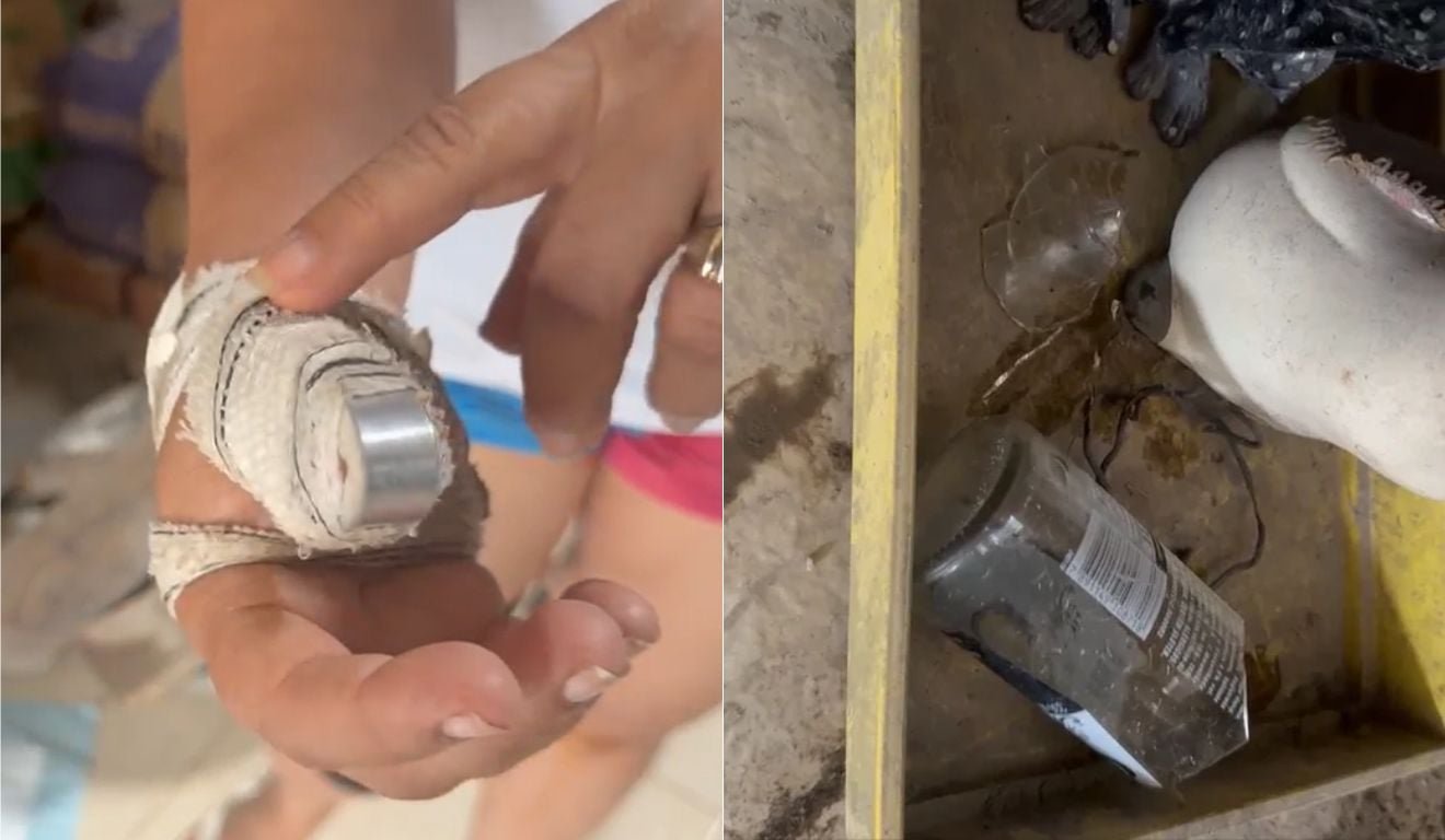 Homem &eacute; preso ap&oacute;s quebrar dedo da m&atilde;e com peda&ccedil;o de madeira em Cariacica