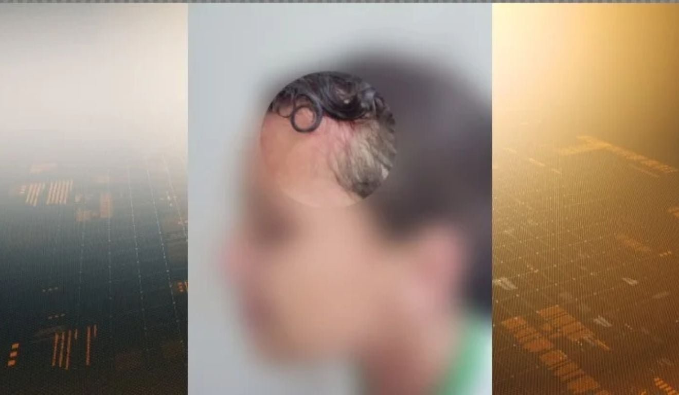 Menina de 12 anos &eacute; atacada a marteladas por colega de sala em Cariacica